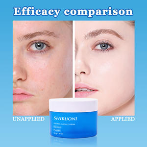 Vente en gros Crème hydratante rétinoïde encapsulée Crème pour le visage anti-âge au rétinol contre les rides - Product Image 4