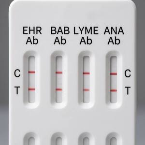 Test 4 en 1 intégré pour l'identification des parasites sanguins EHR BAB LYME ANA Ab – Dépistage multi-infections des maladies transmises par les tiques pour cliniques - Product Image 5