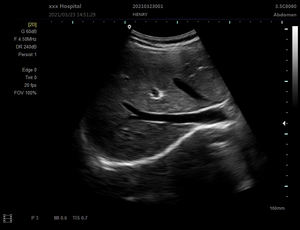 Sistem Diagnostik Ultrasonografi Veteriner Portabel Layar Digital HD Penuh 12,1 Inci untuk Penggunaan Medis - Product Image 5