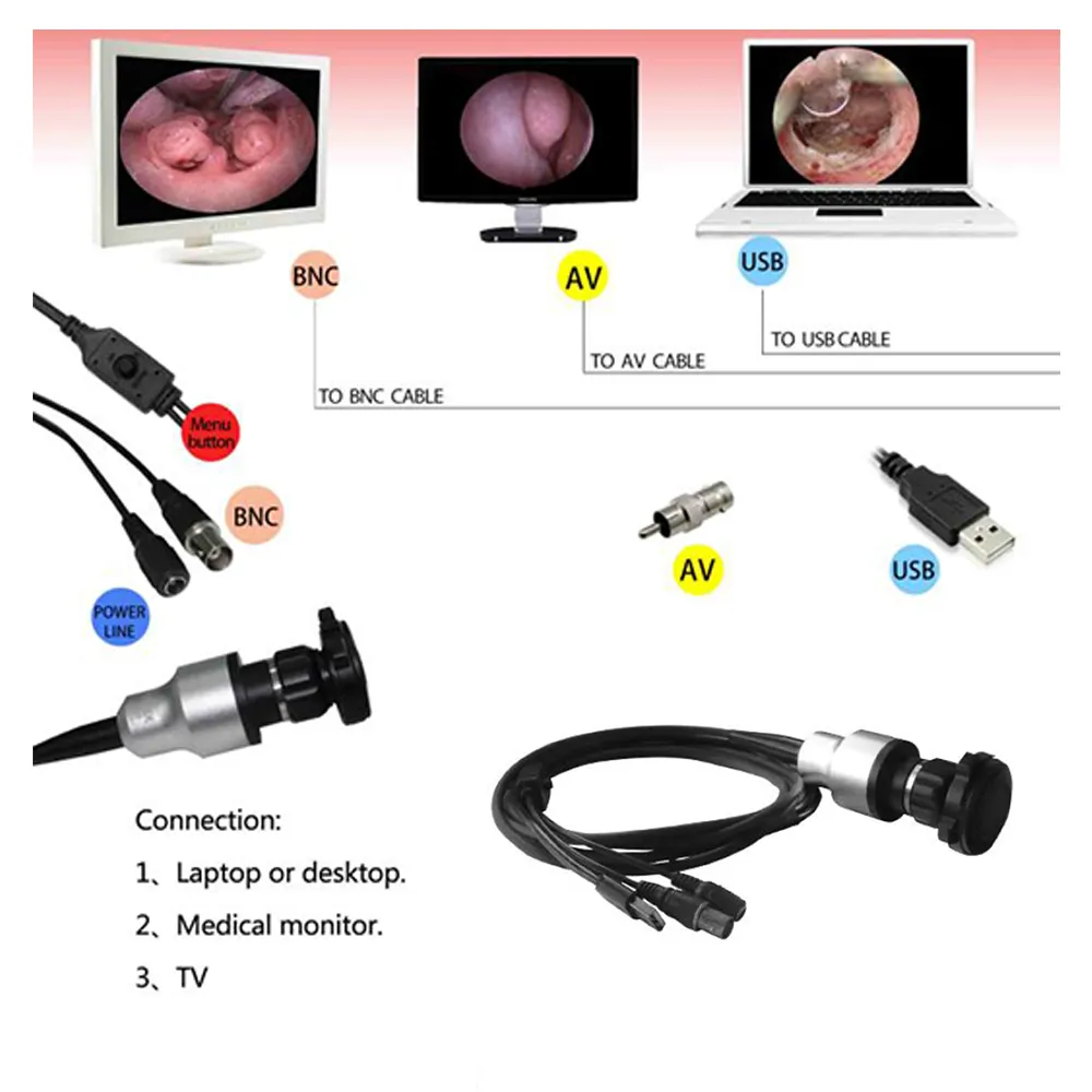 CE Approved whole sale medical ENT video Endoscope usb camera endoscope with gastroscopy & colonoscopy