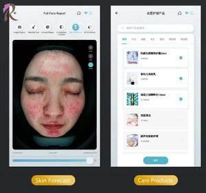 Analizador de Piel Inteligente con Informe de Comparación, Prueba de Humedad, 20 Indicadores de Problemas de la Piel, Ideal para Clínicas Dermatológicas y Spas - Product Image 2