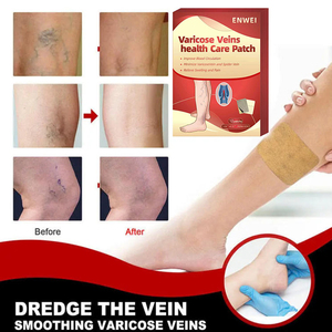 Suplemen Herbal Bersertifikat CE Harga Pabrik untuk Varises, Plester Alami Meningkatkan Penampilan Kaki, Pereda Nyeri, Hipoalergenik - Product Image 2