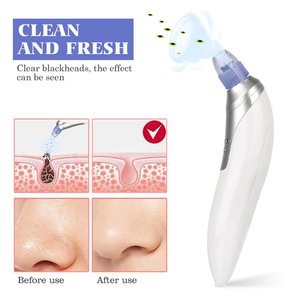 Outfit Beauty rechargeable portable sucking strong remove tool from BLACKHEAD adsorption emptiness al acne herrami - Product Image 3