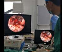 Système d'imagerie médicale hystéroscope portable endoscopie système de caméra endoscope LED