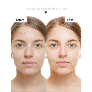 Collagène de grenade de haute qualité, marque privée, peptides de collagène, bâtonnets de gelée de collagène essentiels, soutien pour la santé de la peau, des cheveux et des ongles - Product Image 5