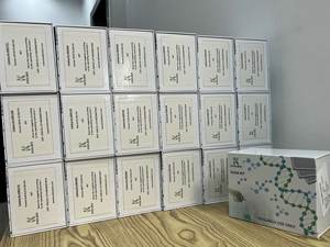 Kit ELISA humano 8-OHdG, 8-Hidroxi-2 '-desoxiguanosina, 96 testes, alta sensibilidade 0,27 Ng/mL, para pesquisa - Product Image 3