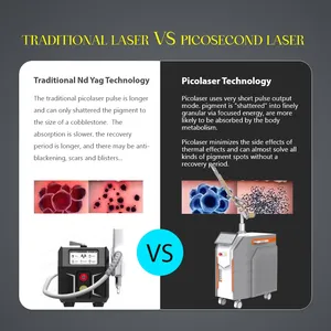 Mesin penghilang tato laser picodetik nd yag daya kuat