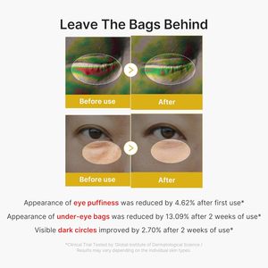 Siero Contorno Occhi Coreano Vegano Medicue Personalizzato con Rullo Massaggiante, Anti-Gonfiore, Anti-Età, Illuminante, con Caffeina, Riparatore per Borse sotto gli Occhi - Product Image 4