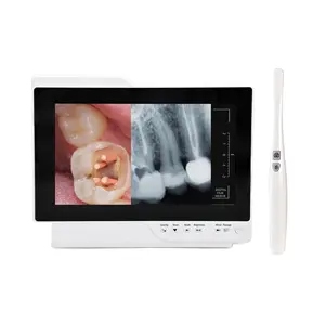 New dental portable oral intelligent observer endoscope X-ray film 2-in-1 with aluminum outer box dental clinic equipment