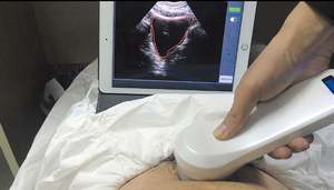 Scanner vétérinaire <span class=keywords><strong>portable</strong></span> haute précision pour la vessie, mini-sonde 4D sans fil, échographe vésical - Product Image 5