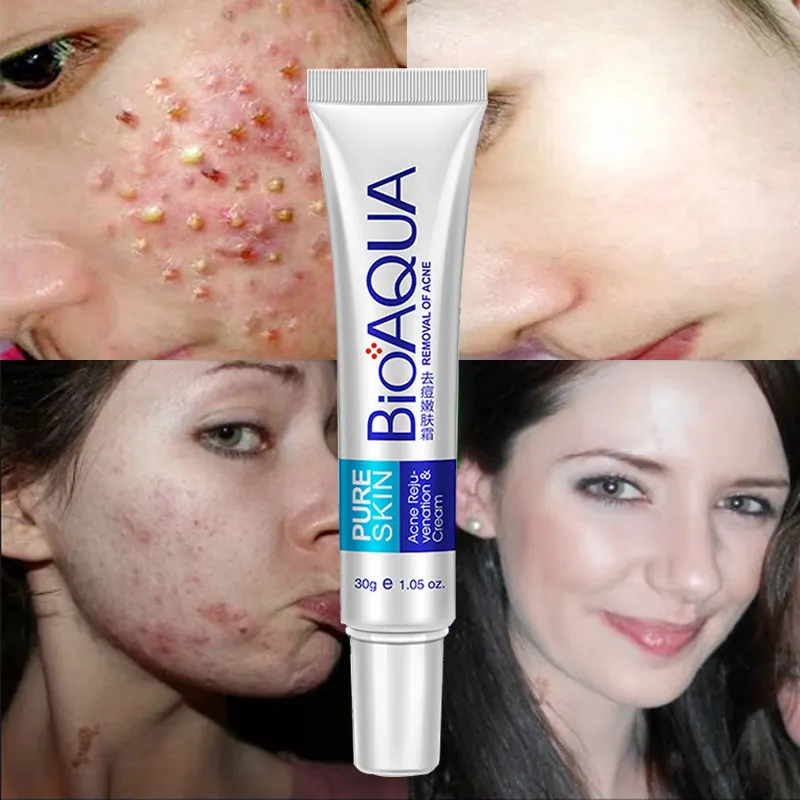 Whitening cream, acne removing spot, moisturizing, autumn , skin care