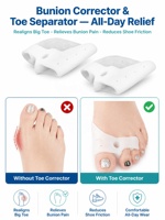 Séparateur d'orteils pour l'amélioration de la déformation du hallux, alignement des orteils varus, support pour le gros orteil pour hommes et femmes, séparateur de hallux valgus