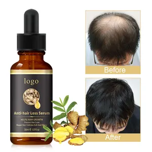 OEM Private Label Anti Hair Loss Products Natural Organic Ginger Anti Hair Fall Treatment Hair Growth Serum