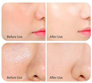 Cápsulas de Suero de Ceramida al por Mayor, Cápsulas de Esencia Facial <span class=keywords><strong>Hidratante</strong></span> con Ceramida, Blanqueadoras y Nutritivas - Product Image 4