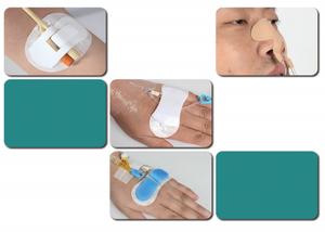 Dispositifs médicaux Accessoires médicaux blancs CE Dispositifs et fournitures médicaux EOS transparents Dispositif de pansement pour plaies - Product Image 3