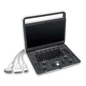 Machine d'ultrasons de sonscope E1, portable à ultrasons