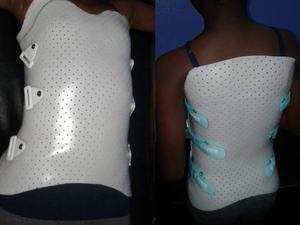 정형 외과 물리 치료 골절 재활 고정 버팀대 크기 600*900mm 멀티 컬러 열가소성 부목 - Product Image 4