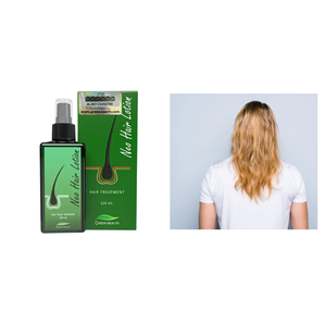 Loción Profesional 100% Orgánica a Base de Hierbas en Spray, 120 ml, Aceite de Coco Fresco de Bangkok, Prevención de la Caída del Cabello, Cuidado Personal - Product Image 1