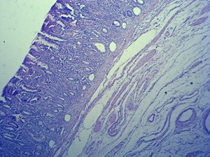 医学HenanYulinプロの人間の病理学スライド人間の炎症について - Product Image 5