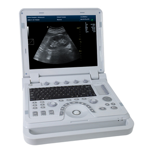 CONTEC CMS1700B BIG Deal Portable <strong>Ultrasound</strong> Machine Color Doppler <strong>Medical</strong> <strong>Ultrasound</strong> <strong>Instruments</strong> - Product Image 1