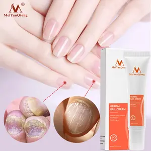 Ongles à base de plantes Onychomycose Paronychia Anti Fongique Nail Infection Bon Résultat Chinois À Base De Plantes Toe Nail Fungus Cream - Product Image 5