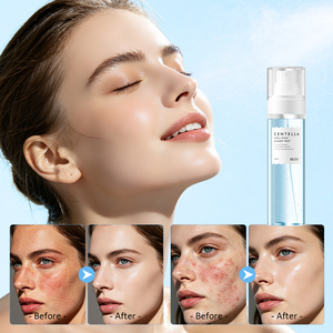 Private Label Centella Asiatica Hyali-Cica Cloudy Mist <b>Moisturizing</b> Dry Skin Hydrating Skin Care Refreshing <b>Spray</b> OEM Toner - Product Image 5