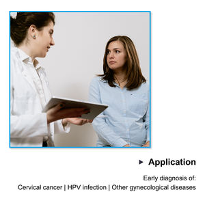 Brosse cervicale jetable Brosse d'échantillonnage cervicale Cyto Brosse de cytologie cervicale - Product Image 4