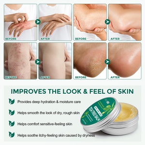 Bálsamo <span class=keywords><strong>de</strong></span> Aceite <span class=keywords><strong>de</strong></span> Árbol <span class=keywords><strong>de</strong></span> Té Natural ELAIMEI, Tratamiento <span class=keywords><strong>para</strong></span> el Cuidado <span class=keywords><strong>de</strong></span> la Piel, Crema <span class=keywords><strong>de</strong></span> Árbol <span class=keywords><strong>de</strong></span> Té <span class=keywords><strong>para</strong></span> Aliviar la Picazón, Pies Secos y Agrietados, Manos y Codos - Product Image 4