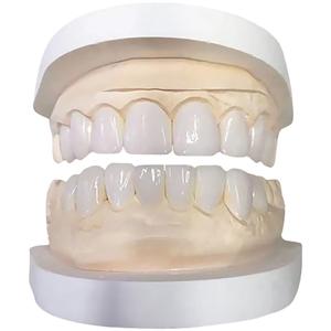 Facettes dentaires en porcelaine bleue tout céramique Dentsply Ivoire, faits à la main, en porcelaine ambrée, sans grincement des dents - Product Image 1