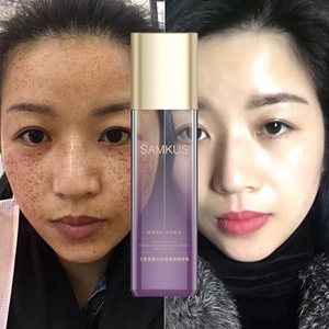 Lait d'essence multi-effets éclaircissant et anti-taches OEM/ODM pour le <span class=keywords><strong>soin</strong></span> du <span class=keywords><strong>visage</strong></span> féminin, éclaircissant et anti-imperfections - Product Image 1