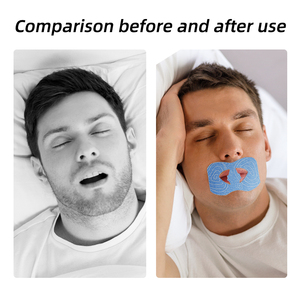 子供用整形外科用口パッチ 不織布製いびき防止マウスピース 大人用睡眠用口パッチ - Product Image 3