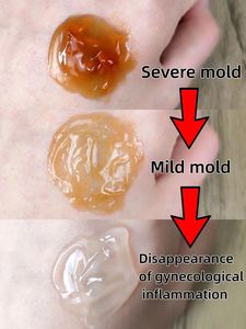 Intieme Gezondheid Natuurlijke Vaginale Aanscherping Gel Postpartum Herstelgel Die Veilig Reinigt En Panty 'S Vagina - Product Image 2