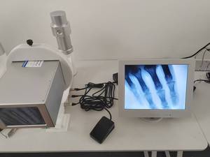 Sistema de Fluoroscopia Portátil Equivalente a Rayos X para Animales, Máquina de Rayos X Portátil Médica - Product Image 3