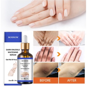 <span class=keywords><strong>Precio</strong></span> de fábrica Crema para nudillos oscuros Codos y rodillas Suero blanqueador rápido fuerte - Product Image 2