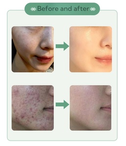Peeling alle alghe peeling <span class=keywords><strong>verde</strong></span> algues green alghe peeling per bellezza e centro estetico medico - Product Image 6
