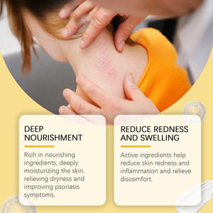 Crème gel à base de plantes soulage le <span class=keywords><strong>psoriasis</strong></span>, réduit les démangeaisons et atténue les douleurs corporelles. - Product Image 4