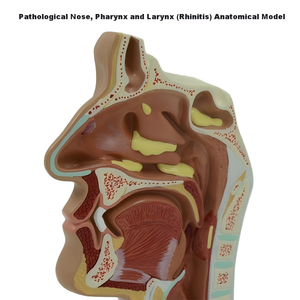 3 buah Set Model nasopyning PVC-Normal + Rhinitis + Model patonomi untuk pengajaran medis & tampilan - Product Image 3