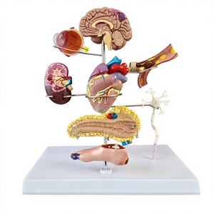 Medicina Humana, Complicaciones <span class=keywords><strong>de</strong></span> la Diabetes, Ojos, Corazón, Riñones, Vasos Sanguíneos, Pie, Cirugía Interna y Externa, Rehabilitación, Patología - Product Image 1