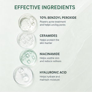 Crema Espumosa para el Acné <span class=keywords><strong>de</strong></span> Máxima Potencia con <span class=keywords><strong>10</strong></span>% <span class=keywords><strong>de</strong></span> Peróxido <span class=keywords><strong>de</strong></span> <span class=keywords><strong>Benzoilo</strong></span>, Elimina el Acné y los Puntos Negros con Ceramida, Ácido Hialurónico y Niacinamida - Product Image 4