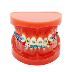Gelsonlab HSDT-B1-02 Dental Orthodontic Teeth Model Typodont with Metal Bracket Arch Wire Chain