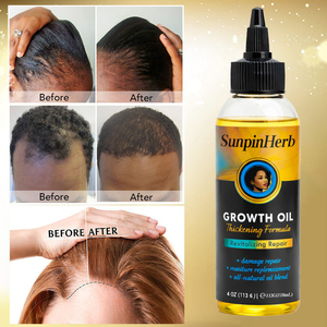 Aceite de Romero para el Crecimiento del Cabello Afro, Tratamiento para el Cuero Cabelludo, Hidratante, Reparador, Anti-Rotura, Marca Privada, Suministro al por Mayor - Product Image 3