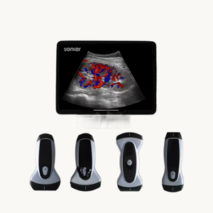 Fitin y tế cầm tay y tế wifi không dây siêu âm thiết bị cầm tay hệ thống máy xách tay - Product Image 5