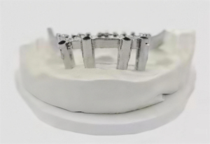 Anodiseur de titane pour bijoux de piercing, petit modèle, avec support de placage métallique, machine d'anodisation du titane pour composants dentaires - Product Image 5