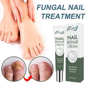 Crema Reparadora de Uñas con Extracto Herbal, Crema de Belleza para Uñas Brillantes, Tratamiento Antifúngico para Uñas de los Pies - Product Image 2