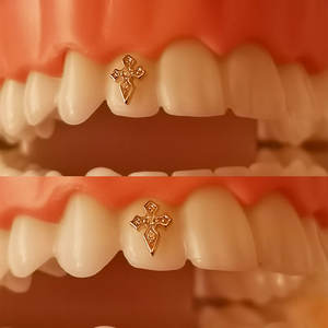 Kit Profesional de Gemas Dentales con Resina Fluida, Dijes de Oro de Lujo de 8K y Juego de Joyería de Cristal al por Mayor - Product Image 6