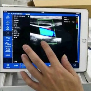 Appareil d'échographie portable, scanner à ultrasons haute fréquence 10 & 14 MHz, équipement d'échographie couleur Doppler numérique, modèle CU13 - Product Image 5
