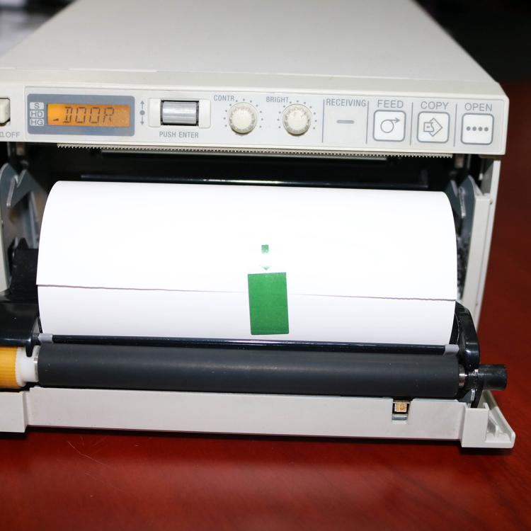 Impresora de video ultrasonido Papel de impresión térmica de medios en blanco y negro de alto brillo Rollo de papel para impresión térmica