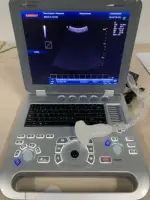 चिकित्सा गर्भावस्था अल्ट्रासाउंड मशीन सभी डिजिटल वायरलेस 3D 4D नैदानिक रंग डॉपलर यूएसजी उपकरण