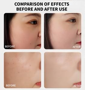 Suero en Spray de Trufa Blanca de 100 ml, Venta al por Mayor, Hidratante Facial Ligero, Suero Iluminador, Líquido Brillante, Cuidado de la Piel Coreano - Product Image 4