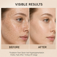 Crème éclaircissante pour les taches sombres OEM 377, crème hydratante pour le visage à la céramide, éclaircissant doux pour la peau, crème de soin pour unifier le teint